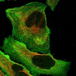 DQX1 Antibody, Novus Biologicals 0.1mL; Unlabeled:Antibodies, Polyclonal