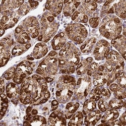 DRAK1 Antibody, Novus Biologicals 25 &mu;L; Unlabeled:Antibodies, Polyclonal