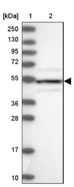 DRAK1 Antibody, Novus Biologicals 25 &mu;L; Unlabeled:Antibodies, Polyclonal