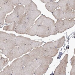 DRAK2 Antibody, Novus Biologicals 25 &mu;L; Unlabeled:Antibodies, Polyclonal