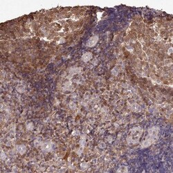 DRAK2 Antibody, Novus Biologicals 25 &mu;L; Unlabeled:Antibodies, Polyclonal
