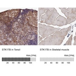 DRAK2 Antibody, Novus Biologicals 25 &mu;L; Unlabeled:Antibodies, Polyclonal