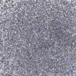 DRAM2 Antibody, Novus Biologicals:Antikroppar:Primära antikroppar