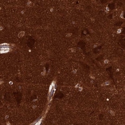 DRP1 Antibody, Novus Biologicals 25 &mu;L, Unlabeled:Antibodies, Polyclonal