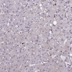 DRP1 Antibody, Novus Biologicals 25 &mu;L, Unlabeled:Antibodies, Polyclonal