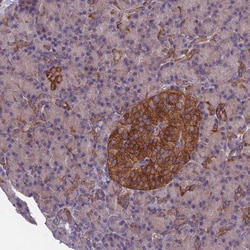 DRP1 Antibody, Novus Biologicals 25 &mu;L, Unlabeled:Antibodies, Polyclonal