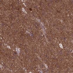 DRP1 Antibody, Novus Biologicals 25 &mu;L, Unlabeled:Antibodies, Polyclonal