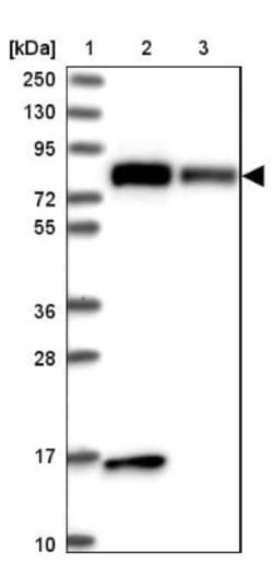 DRP1 Antibody, Novus Biologicals 25 &mu;L, Unlabeled:Antibodies, Polyclonal