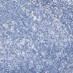 DSCAM Antibody, Novus Biologicals 25 &mu;L, Unlabeled:Antibodies, Polyclonal