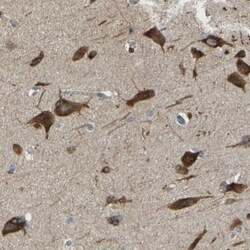 DSCAM Antibody, Novus Biologicals 25 &mu;L, Unlabeled:Antibodies, Polyclonal