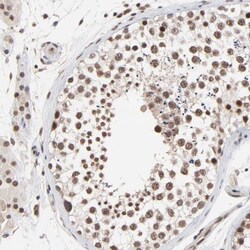 DSN1 Antibody, Novus Biologicals:Antibodies:Primary Antibodies