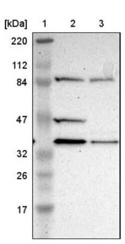 DSN1 Antibody, Novus Biologicals:Antibodies:Primary Antibodies