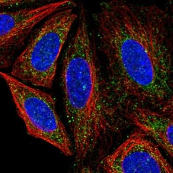 DTD2 Antibody, Novus Biologicals:Antibodies:Primary Antibodies