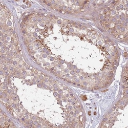 DTD2 Antibody, Novus Biologicals:Antibodies:Primary Antibodies