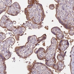 DTD2 Antibody, Novus Biologicals:Antibodies:Primary Antibodies