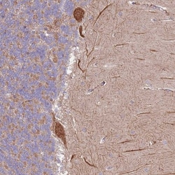 DTD2 Antibody, Novus Biologicals:Antibodies:Primary Antibodies