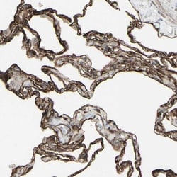 DTX3L Antibody, Novus Biologicals 0.1mL; Unlabeled:Antibodies, Polyclonal
