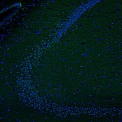 DTX4 Antibody, Novus Biologicals 0.1mL; Unlabeled:Antibodies, Polyclonal