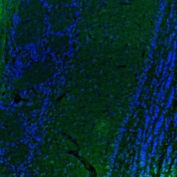DTX4 Antibody, Novus Biologicals 0.1mL; Unlabeled:Antibodies, Polyclonal
