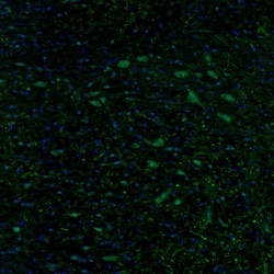 DTX4 Antibody, Novus Biologicals 0.1mL; Unlabeled:Antibodies, Polyclonal