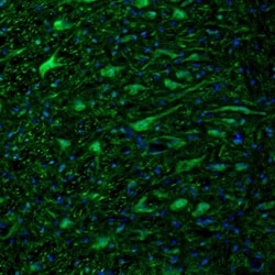 DTX4 Antibody, Novus Biologicals 0.1mL; Unlabeled:Antibodies, Polyclonal