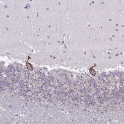 DTX4 Antibody, Novus Biologicals 0.1mL; Unlabeled:Antibodies, Polyclonal