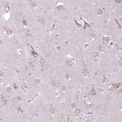 DTX4 Antibody, Novus Biologicals 0.1mL; Unlabeled:Antibodies, Polyclonal