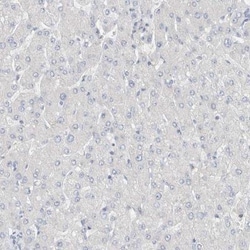 DUOX1 Antibody, Novus Biologicals 0.1mL; Unlabeled:Antibodies, Polyclonal