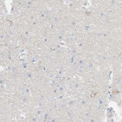 DUOX1 Antibody, Novus Biologicals 0.1mL; Unlabeled:Antibodies, Polyclonal