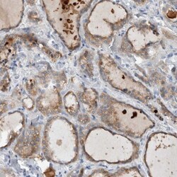 DUOX1 Antibody, Novus Biologicals 0.1mL; Unlabeled:Antibodies, Polyclonal