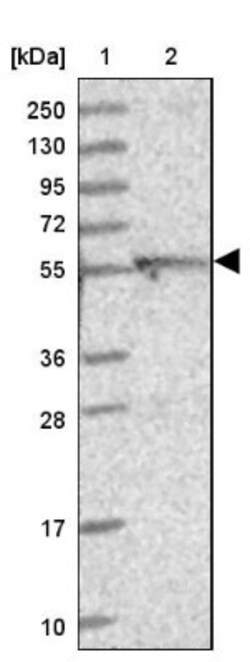 DUS2L Antibody, Novus Biologicals 25 &mu;L | Buy Online | Novus Biologicals | Fisher Scientific