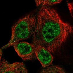 DUSP10 Antibody, Novus Biologicals 25 &mu;L; Unlabeled:Antibodies, Polyclonal