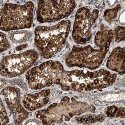 DUSP10 Antibody, Novus Biologicals 25 &mu;L; Unlabeled:Antibodies, Polyclonal