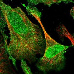 DUSP14 Antibody, Novus Biologicals 0.1mL; Unlabeled:Antibodies, Polyclonal