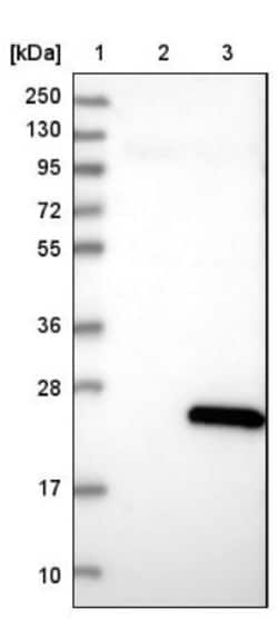 DUSP22 Antibody, Novus Biologicals 0.1mL; Unlabeled:Antibodies, Polyclonal