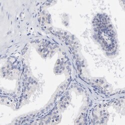 DUSP9 Antibody, Novus Biologicals:Antibodies:Primary Antibodies
