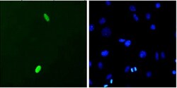 DUX4 Antibody (P2B1), Novus Biologicals 0.1mg; Unlabeled:Antibodies, Monoclonal