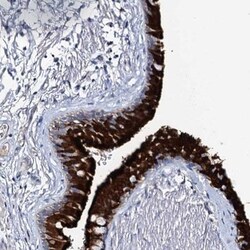 DYDC2 Antibody, Novus Biologicals 25 &mu;L | Buy Online | Novus Biologicals | Fisher Scientific