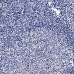 DYDC2 Antibody, Novus Biologicals 25 &mu;L | Buy Online | Novus Biologicals | Fisher Scientific