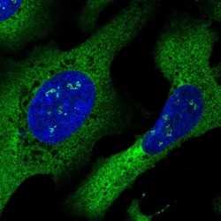 DYNC1I2 Antibody, Novus Biologicals:Antibodies:Primary Antibodies