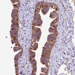 DYNC2H1 Antibody, Novus Biologicals 25 &mu;L, Unlabeled:Antibodies, Polyclonal