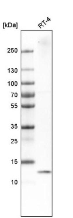 DYNLT3 Antibody, Novus Biologicals:Antibodies:Primary Antibodies