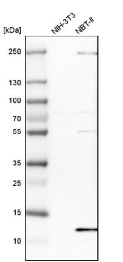 DYNLT3 Antibody, Novus Biologicals:Antibodies:Primary Antibodies