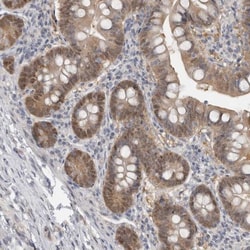 DYRK2 Antibody, Novus Biologicals:Antibodies:Primary Antibodies