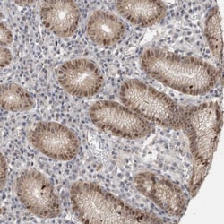 DYRK2 Antibody, Novus Biologicals:Antibodies:Primary Antibodies