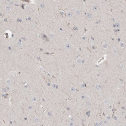 DYRK2 Antibody, Novus Biologicals:Antibodies:Primary Antibodies