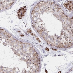 DYRK4 Antibody, Novus Biologicals:Antibodies:Primary Antibodies