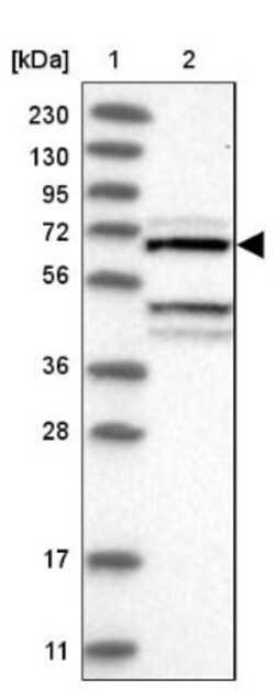 DYRK4 Antibody, Novus Biologicals 0.1mL; Unlabeled:Antibodies, Polyclonal