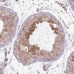 DYX1C1 Antibody, Novus Biologicals 25 &mu;L; Unlabeled:Antibodies, Polyclonal