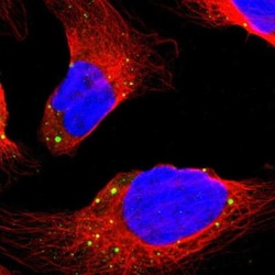 Dcp1a Antibody, Novus Biologicals:Antibodies:Primary Antibodies